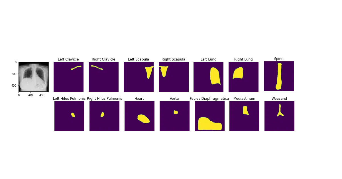 torchxrayvision