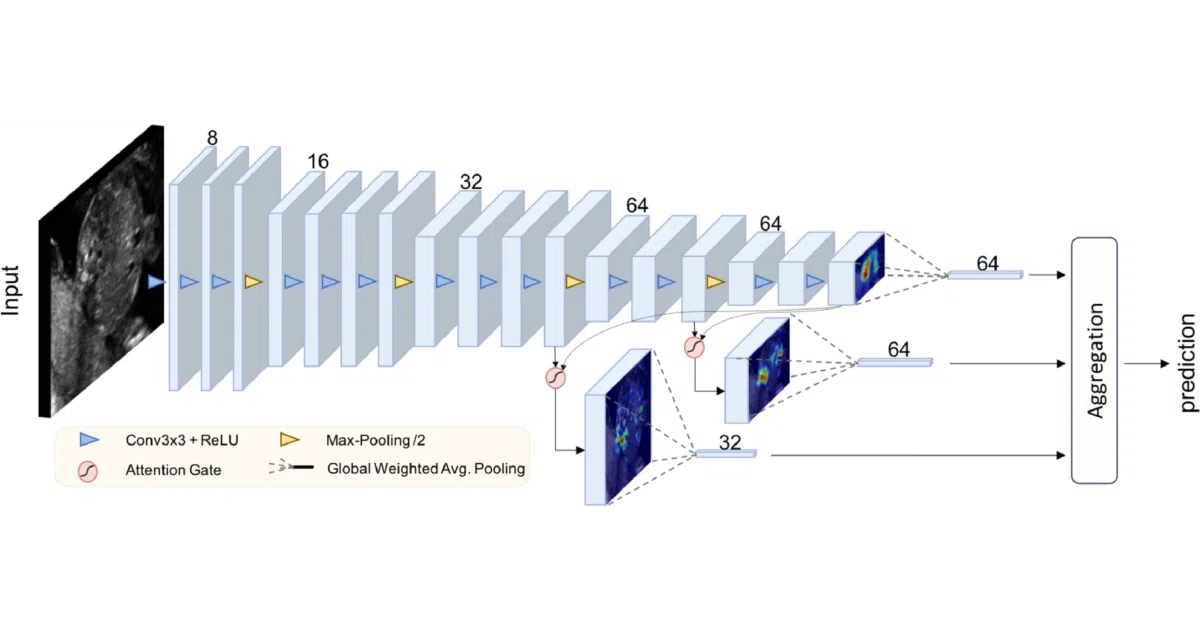 Attention-Gated-Networks