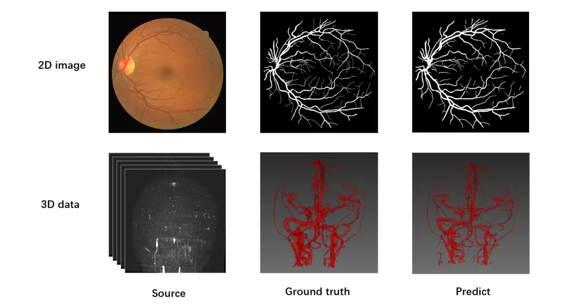 Pytorch-Medical-Segmentation
