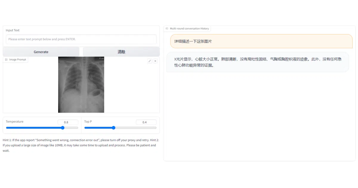 XrayGLM